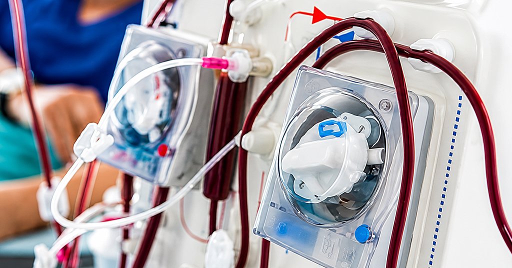 connection between dialysis fluids and infection control